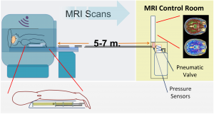 mri-concept